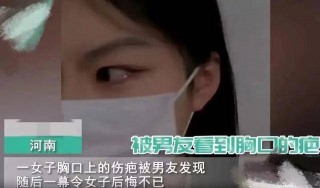 新澳门免费资料大全精准版_ 男子脱掉女友的内裤，发现女友胸口有一道被前男友烧伤的疤痕。 男朋友沉默不语。